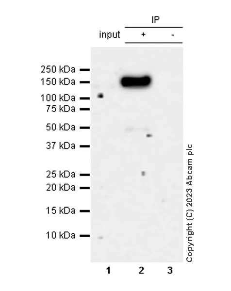 Immunoprecipitation - Anti-ERAP2 antibody [EPR26475-10] - BSA and Azide free (AB313568)
