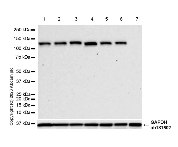 Western blot - Anti-ERAP2 antibody [EPR26475-10] - BSA and Azide free (AB313568)