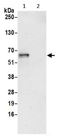 Immunoprecipitation - Anti-Erasin antibody (AB242088)