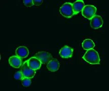 Immunocytochemistry/ Immunofluorescence - Anti-ErbB2 / HER2 Affibody® Molecule (FITC) (AB31891)