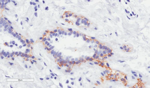 Immunohistochemistry (Formalin/PFA-fixed paraffin-embedded sections) - Anti-ErbB2 / HER2 antibody [4D5-8] (AB245702)