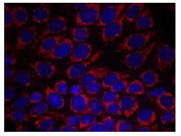 Immunocytochemistry/ Immunofluorescence - Anti-ErbB2 / HER2 antibody (AB131490)