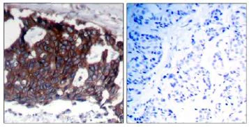 Immunohistochemistry (Formalin/PFA-fixed paraffin-embedded sections) - Anti-ErbB2 / HER2 antibody (AB131490)