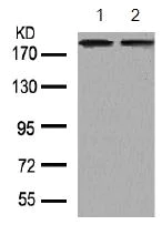 Western blot - Anti-ErbB2 / HER2 antibody (AB131490)