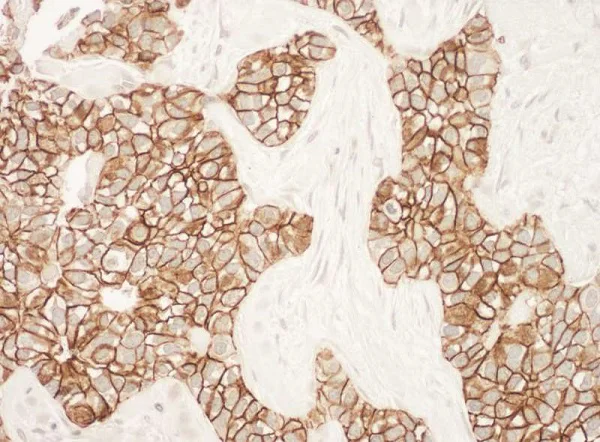 Immunohistochemistry (Formalin/PFA-fixed paraffin-embedded sections) - Anti-ErbB2 / HER2 antibody (AB245336)