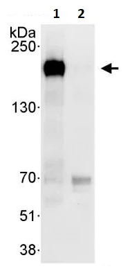 Immunoprecipitation - Anti-ErbB2 / HER2 antibody (AB245336)