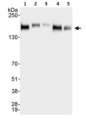 Western blot - Anti-ErbB2 / HER2 antibody (AB245336)