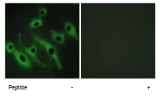 Immunocytochemistry/ Immunofluorescence - Anti-ErbB2 / HER2 antibody (AB69647)