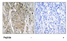 Immunohistochemistry (Formalin/PFA-fixed paraffin-embedded sections) - Anti-ErbB2 / HER2 antibody (AB69647)