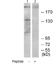 Western blot - Anti-ErbB2 / HER2 antibody (AB69647)