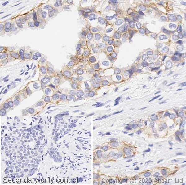 Immunohistochemistry (Formalin/PFA-fixed paraffin-embedded sections) - Anti-ErbB2 / HER2 antibody [CAL27] (AB237715)