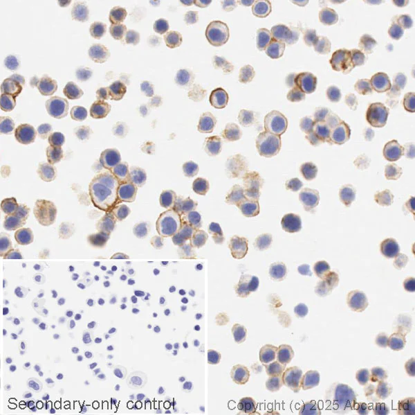 Immunohistochemistry (Formalin/PFA-fixed paraffin-embedded sections) - Anti-ErbB2 / HER2 antibody [CAL27] (AB237715)