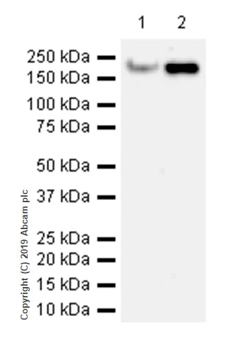 Western blot - Anti-ErbB2 / HER2 antibody [CAL27] (AB237715)
