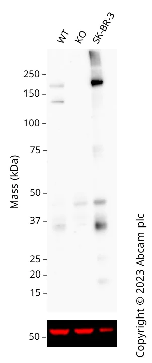 Western blot - Anti-ErbB2 / HER2 antibody [CAL27] (AB237715)