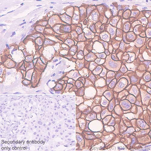 Immunohistochemistry (Formalin/PFA-fixed paraffin-embedded sections) - Anti-ErbB2 / HER2 antibody [CAL27] - BSA and Azide free (AB251602), expandable thumbnail