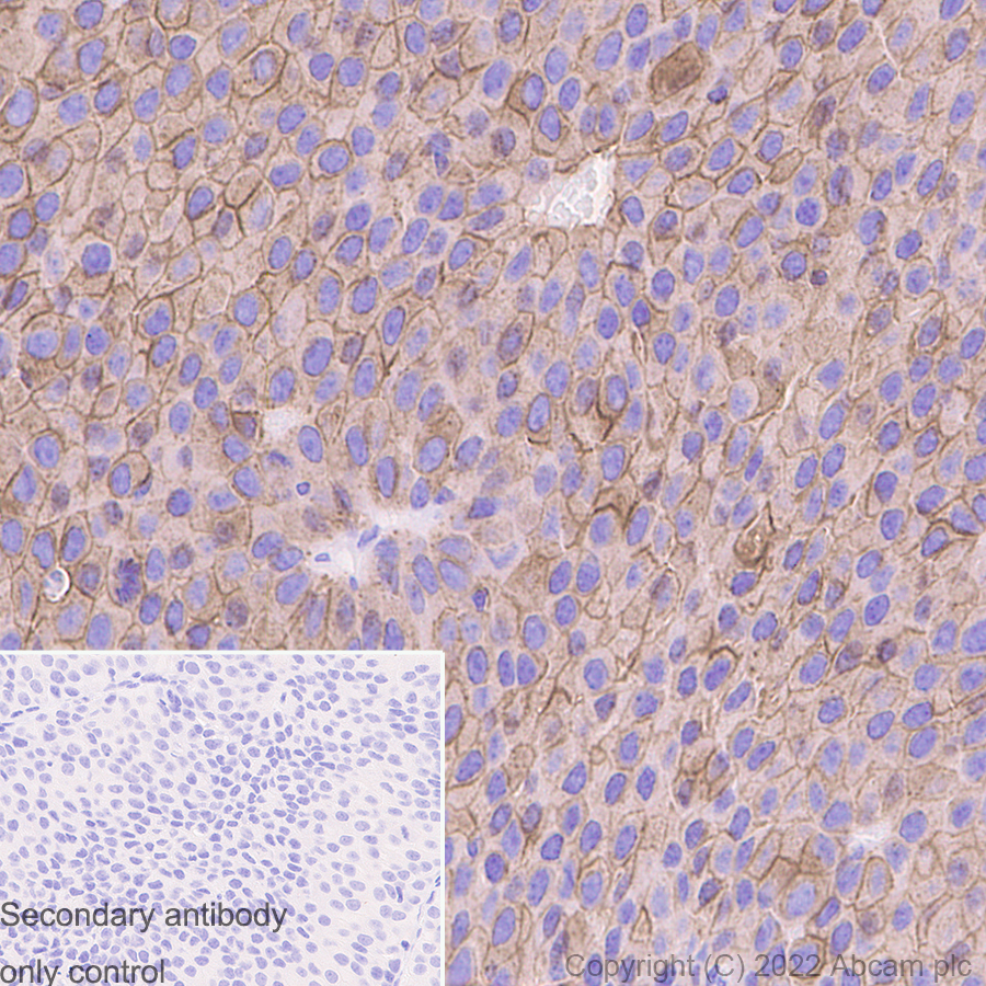 Immunohistochemistry (Formalin/PFA-fixed paraffin-embedded sections) - Anti-ErbB2 / HER2 antibody [CAL27] - BSA and Azide free (ab251602), expandable thumbnail