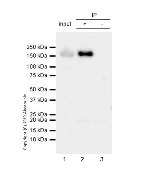 Immunoprecipitation - Anti-ErbB2 / HER2 antibody [CAL27] - BSA and Azide free (AB251602), expandable thumbnail