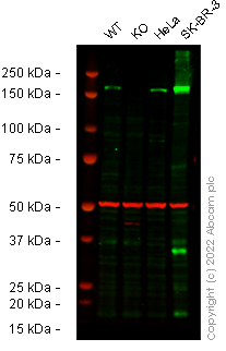 Western blot - Anti-ErbB2 / HER2 antibody [CAL27] - BSA and Azide free (ab251602), expandable thumbnail