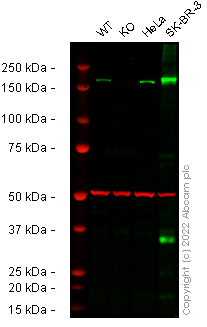 Western blot - Anti-ErbB2 / HER2 antibody [CAL27] - BSA and Azide free (ab251602), expandable thumbnail