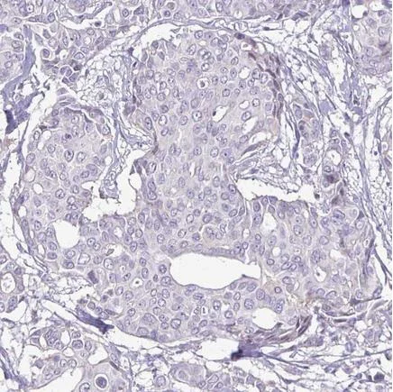 Immunohistochemistry (Formalin/PFA-fixed paraffin-embedded sections) - Anti-ErbB2 / HER2 antibody [CL0268] (AB242195)