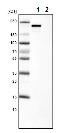 Western blot - Anti-ErbB2 / HER2 antibody [CL0268] (AB242195)