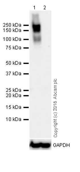 Western blot - Anti-ErbB2 / HER2 antibody [CPT-R32.2-27-12] (AB241325)