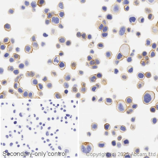 Immunohistochemistry (Formalin/PFA-fixed paraffin-embedded sections) - Anti-ErbB2 / HER2 antibody [EP1045Y] (AB134182)