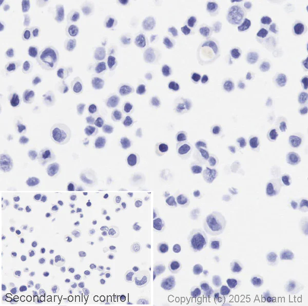 Immunohistochemistry (Formalin/PFA-fixed paraffin-embedded sections) - Anti-ErbB2 / HER2 antibody [EP1045Y] (AB134182)