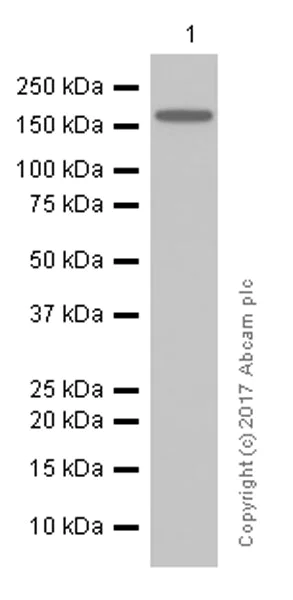 Western blot - Anti-ErbB2 / HER2 antibody [EP1045Y] (AB134182)
