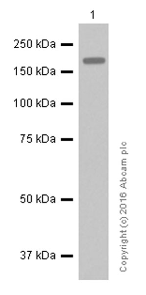 Western blot - Anti-ErbB2 / HER2 antibody [EP1045Y] (AB134182), expandable thumbnail