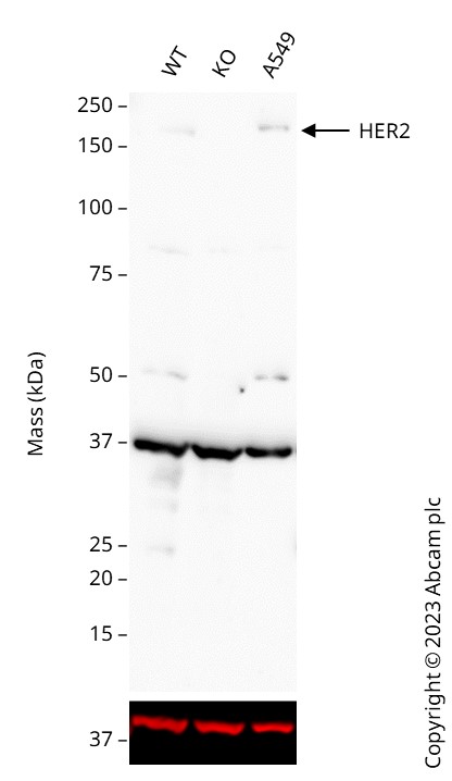 Western blot - Anti-ErbB2 / HER2 antibody [EP1045Y] (ab134182), expandable thumbnail