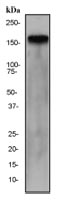 Western blot - Anti-ErbB2 / HER2 antibody [EP1045Y] (ab134182), expandable thumbnail