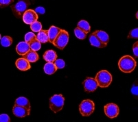Immunocytochemistry/ Immunofluorescence - Anti-ErbB2 / HER2 antibody [EP1045Y] - BSA and Azide free (ab194979), expandable thumbnail