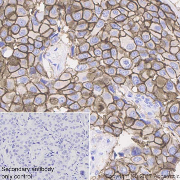 Immunohistochemistry (Formalin/PFA-fixed paraffin-embedded sections) - Anti-ErbB2 / HER2 antibody [EP1045Y] - BSA and Azide free (AB194979), expandable thumbnail