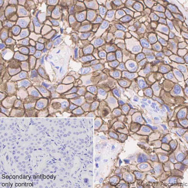 Immunohistochemistry (Formalin/PFA-fixed paraffin-embedded sections) - Anti-ErbB2 / HER2 antibody [EP1045Y] - BSA and Azide free (AB194979)