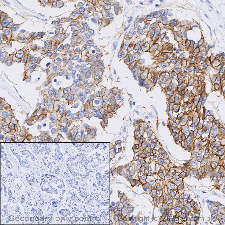Immunohistochemistry (Formalin/PFA-fixed paraffin-embedded sections) - Anti-ErbB2 / HER2 antibody [EP1045Y] - BSA and Azide free (AB194979)