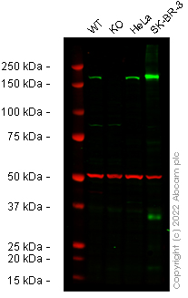 Western blot - Anti-ErbB2 / HER2 antibody [EP1045Y] - BSA and Azide free (ab194979), expandable thumbnail