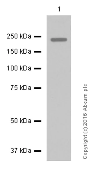 Western blot - Anti-ErbB2 / HER2 antibody [EP1045Y] - BSA and Azide free (AB194979)