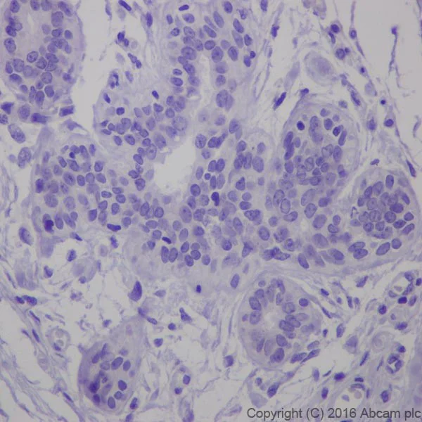 Immunohistochemistry (Formalin/PFA-fixed paraffin-embedded sections) - Anti-ErbB2 / HER2 antibody [EPR19547-12] (AB214275)
