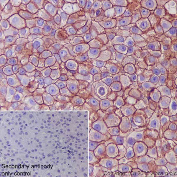 Immunohistochemistry (Formalin/PFA-fixed paraffin-embedded sections) - Anti-ErbB2 / HER2 antibody [EPR19547-12] (AB214275)