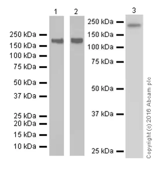 Western blot - Anti-ErbB2 / HER2 antibody [EPR19547-12] (AB214275)