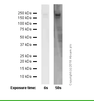 Western blot - Anti-ErbB2 / HER2 antibody [EPR19547-12] (AB214275)