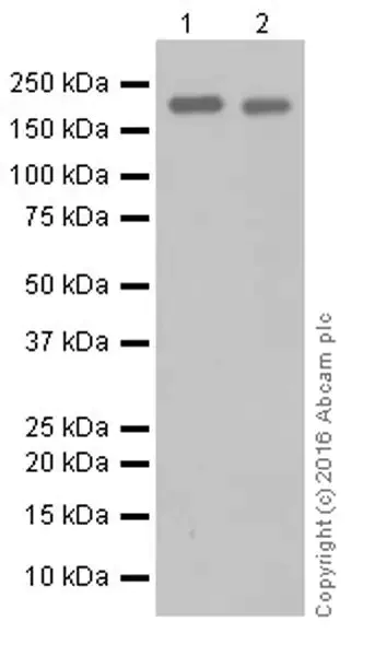 Western blot - Anti-ErbB2 / HER2 antibody [EPR19547-12] (AB214275)