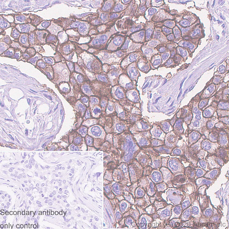 Immunohistochemistry (Formalin/PFA-fixed paraffin-embedded sections) - Anti-ErbB2 / HER2 antibody [H2Mab-139] - BSA and Azide free (AB264548)