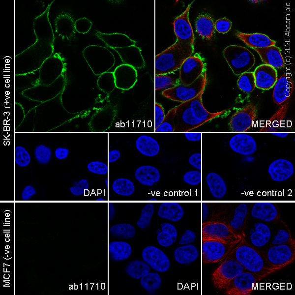 Immunocytochemistry/ Immunofluorescence - Anti-ErbB2 / HER2 antibody [ICR12] (AB11710), expandable thumbnail