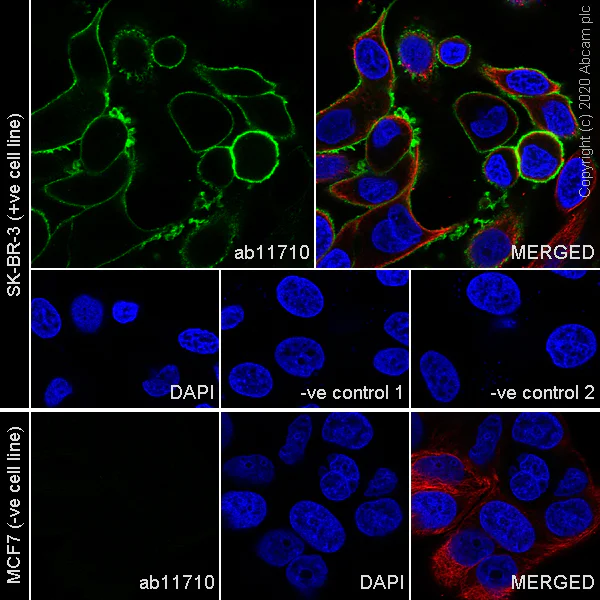 Immunocytochemistry/ Immunofluorescence - Anti-ErbB2 / HER2 antibody [ICR12] (AB11710)