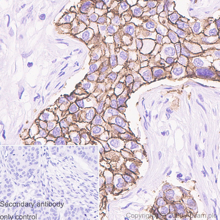 Immunohistochemistry (Formalin/PFA-fixed paraffin-embedded sections) - Anti-ErbB2 / HER2 antibody [ICR12] (AB11710), expandable thumbnail