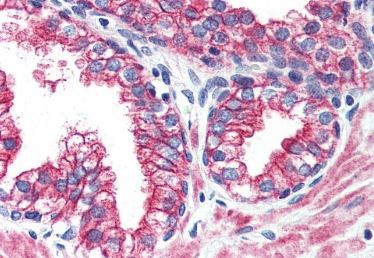 Immunohistochemistry (Formalin/PFA-fixed paraffin-embedded sections) - Anti-ErbB2 / HER2 antibody - N-terminal (AB219062)
