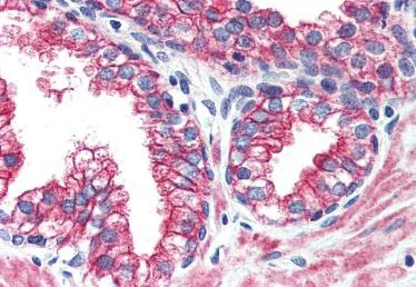 Immunohistochemistry (Formalin/PFA-fixed paraffin-embedded sections) - Anti-ErbB2 / HER2 antibody - N-terminal (AB219062)