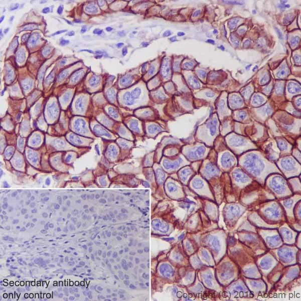 Immunohistochemistry (Formalin/PFA-fixed paraffin-embedded sections) - ErbB2 / HER2 Antibody Panel (EP1045Y, EPR19547-12, SP3, SP101, CAL27) (AB252204)
